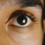 Discapacidad por visión subnormal