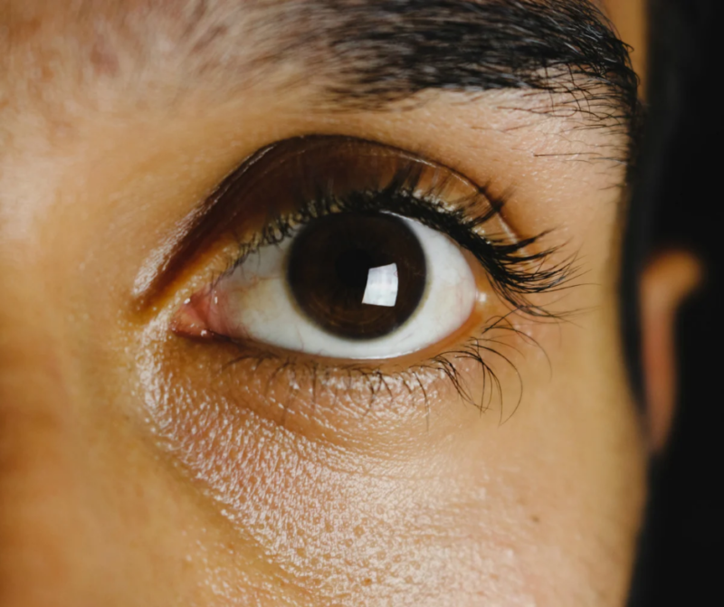 Discapacidad por visión subnormal